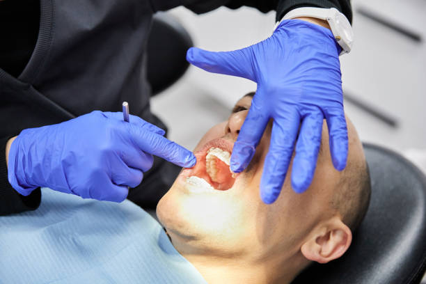 Best Emergency Gum Treatment in Calcutta, OH